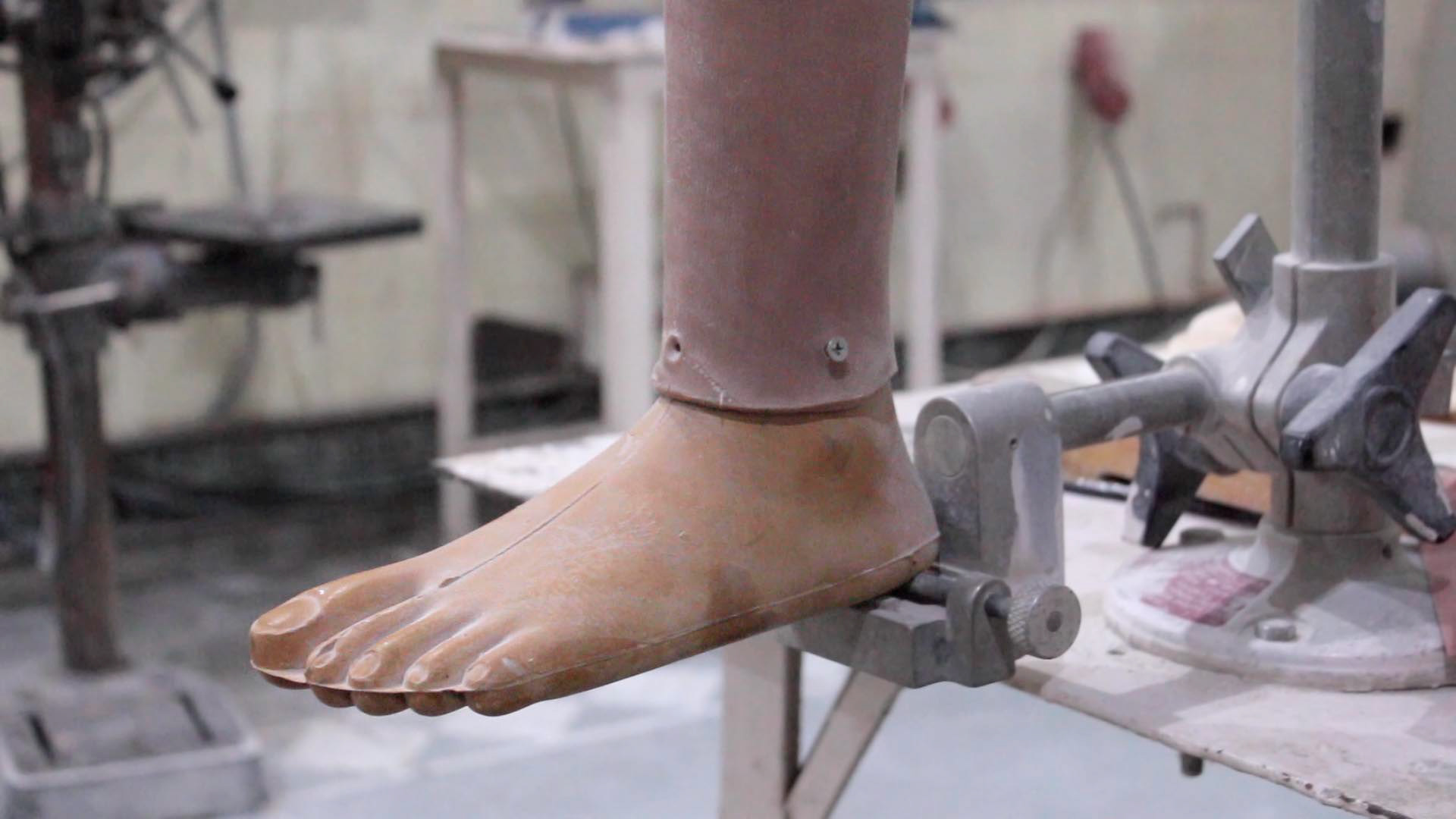 Anna Miers Jaipur Foot