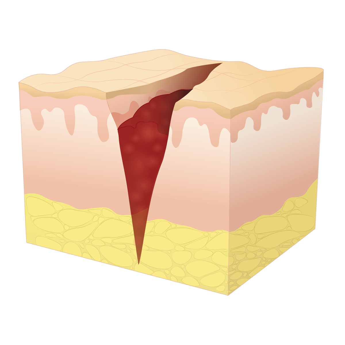 Alexandra Altamuro Wound Healing Diagrams