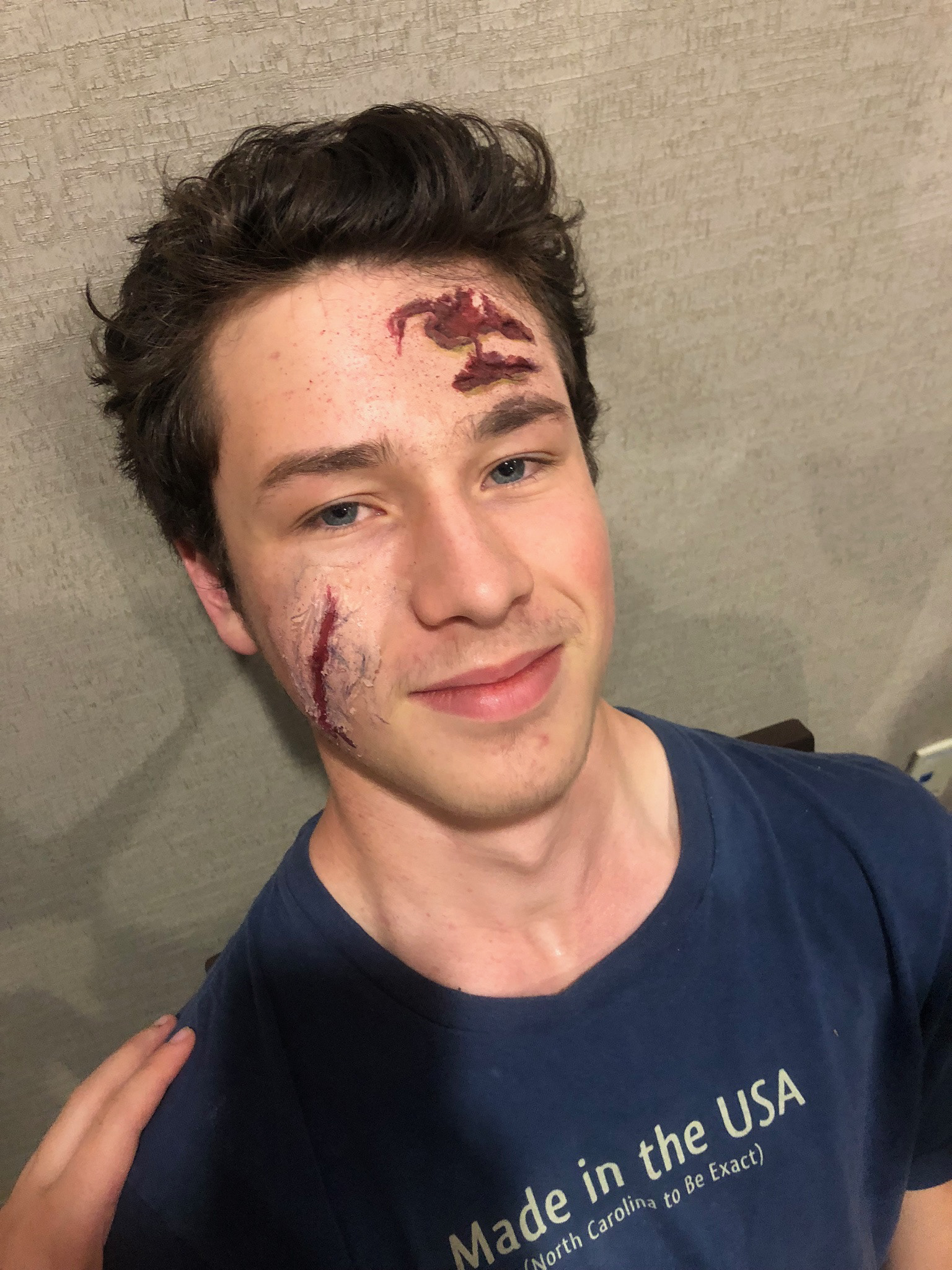 January 2019—That's Going to Leave a Scar