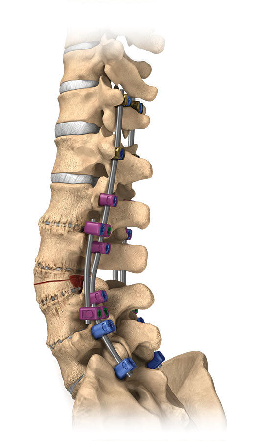 Medical Illustration | Certified Medical Illustrator - Orthopedic