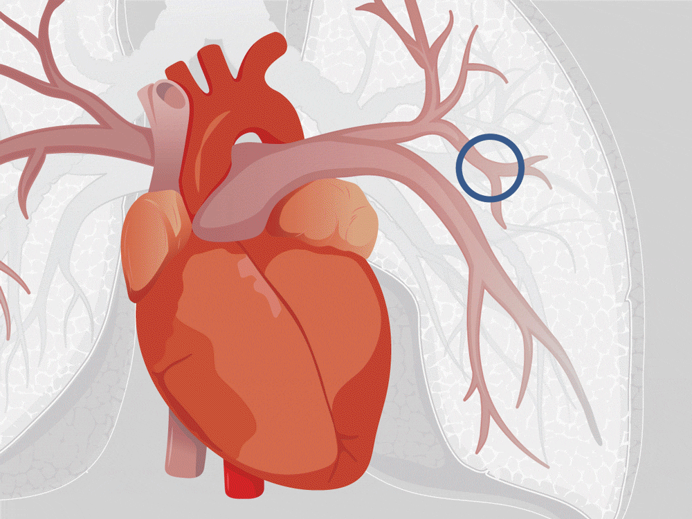 Medical illustration for Driscoll Bell, LLC