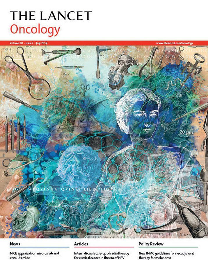 Carmen Ziervogel Illustration - The Lancet Oncology Cover 2019