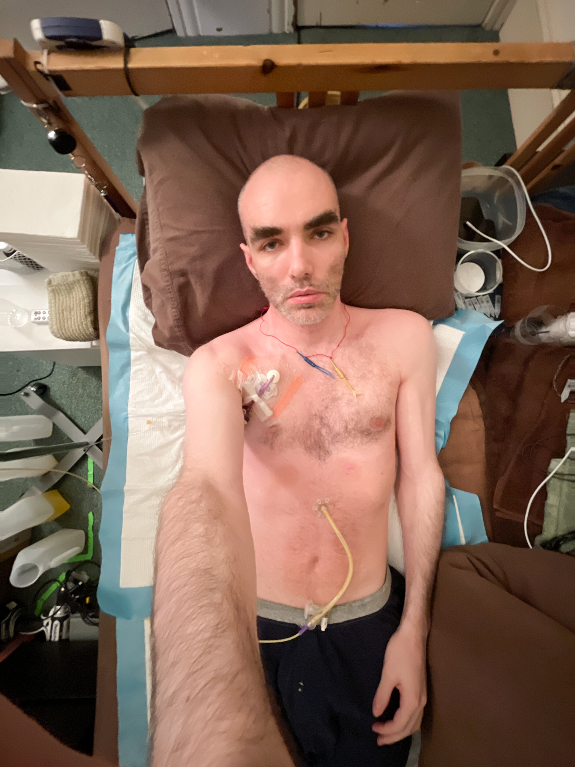 Life with severe ME/CFS.