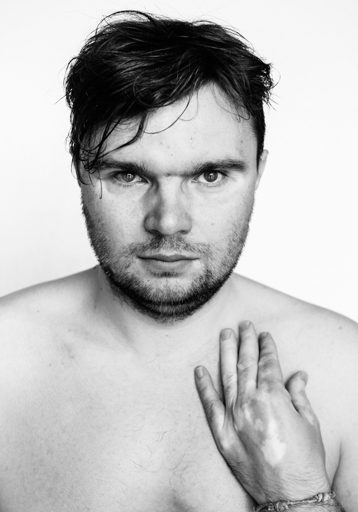 Black and white medium headshot. A male model looks intently at the camera, resting 1 hand gently over his heart, fingers lightly pinching below his collarbone. He has a light skin tone with dappled patches of vitiligo across the back of his hand.