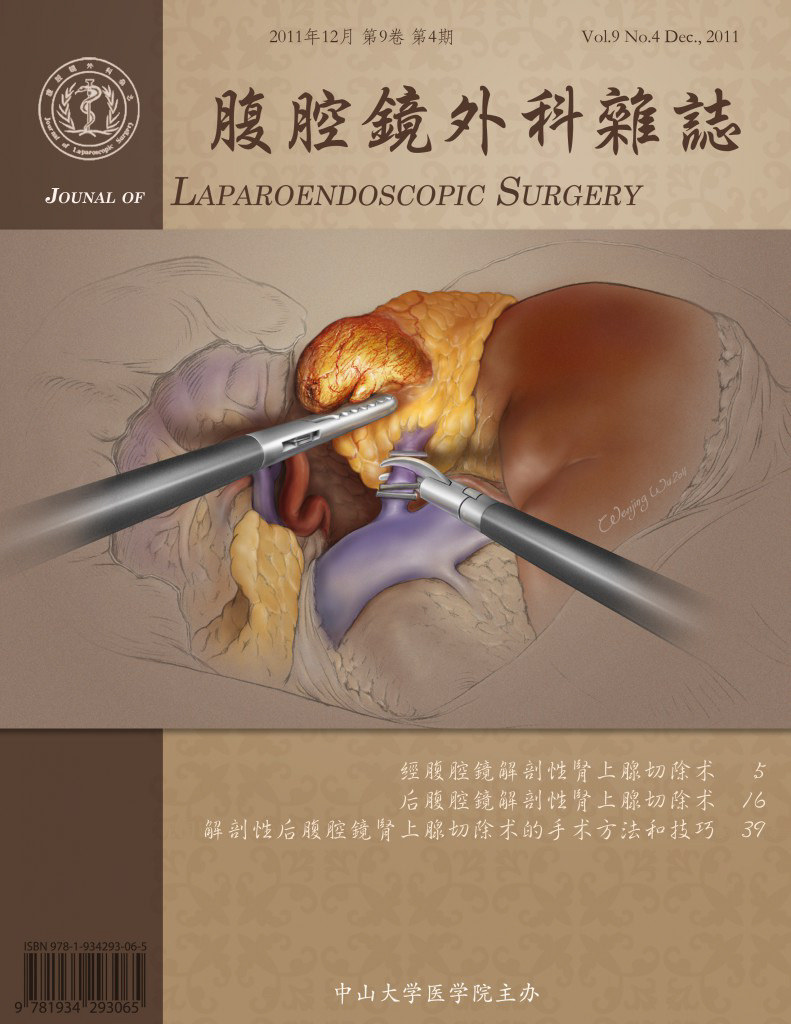 laparoscopic left adrenalectomy